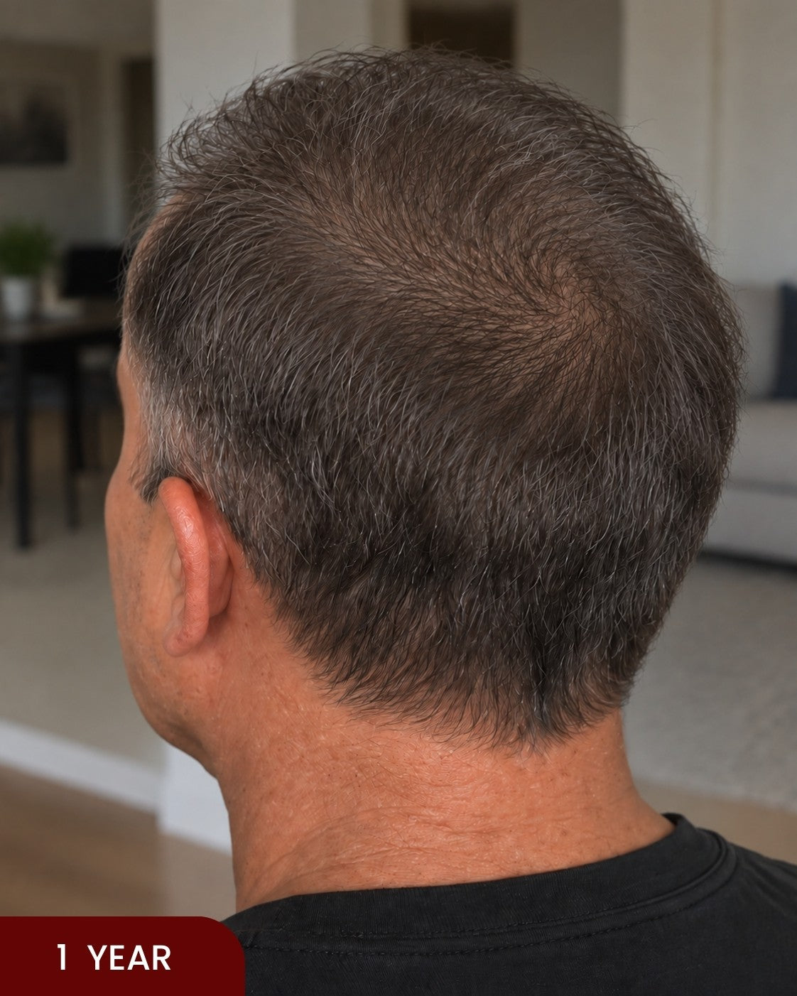 After hair progress photo