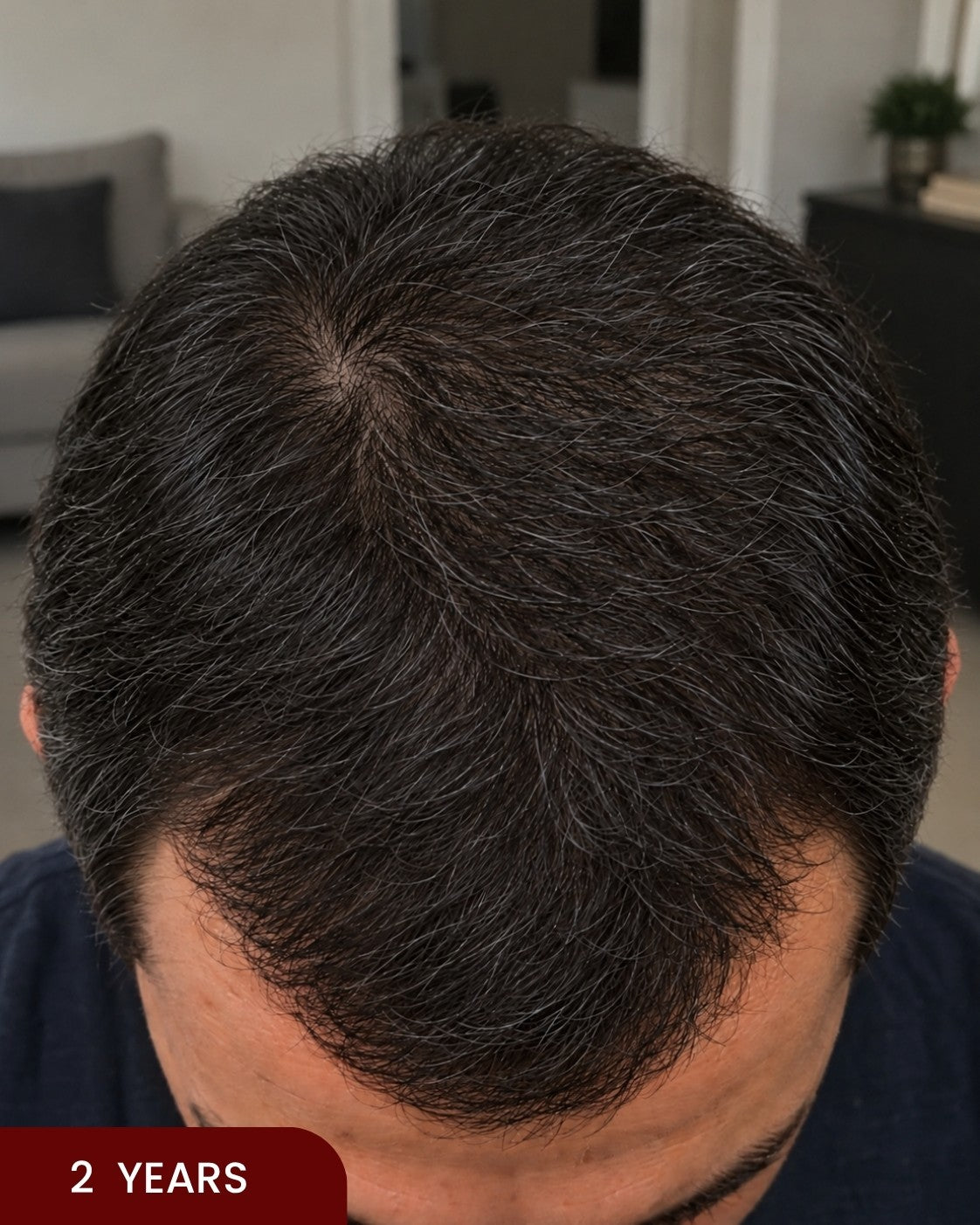 After hair progress photo