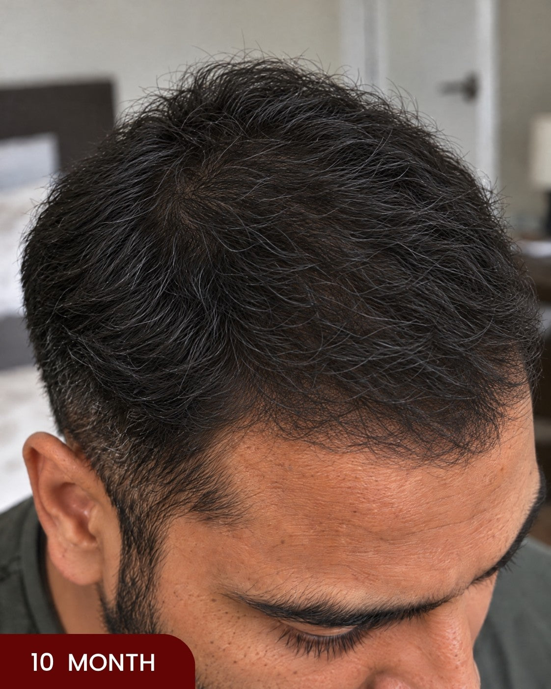 After hair progress photo