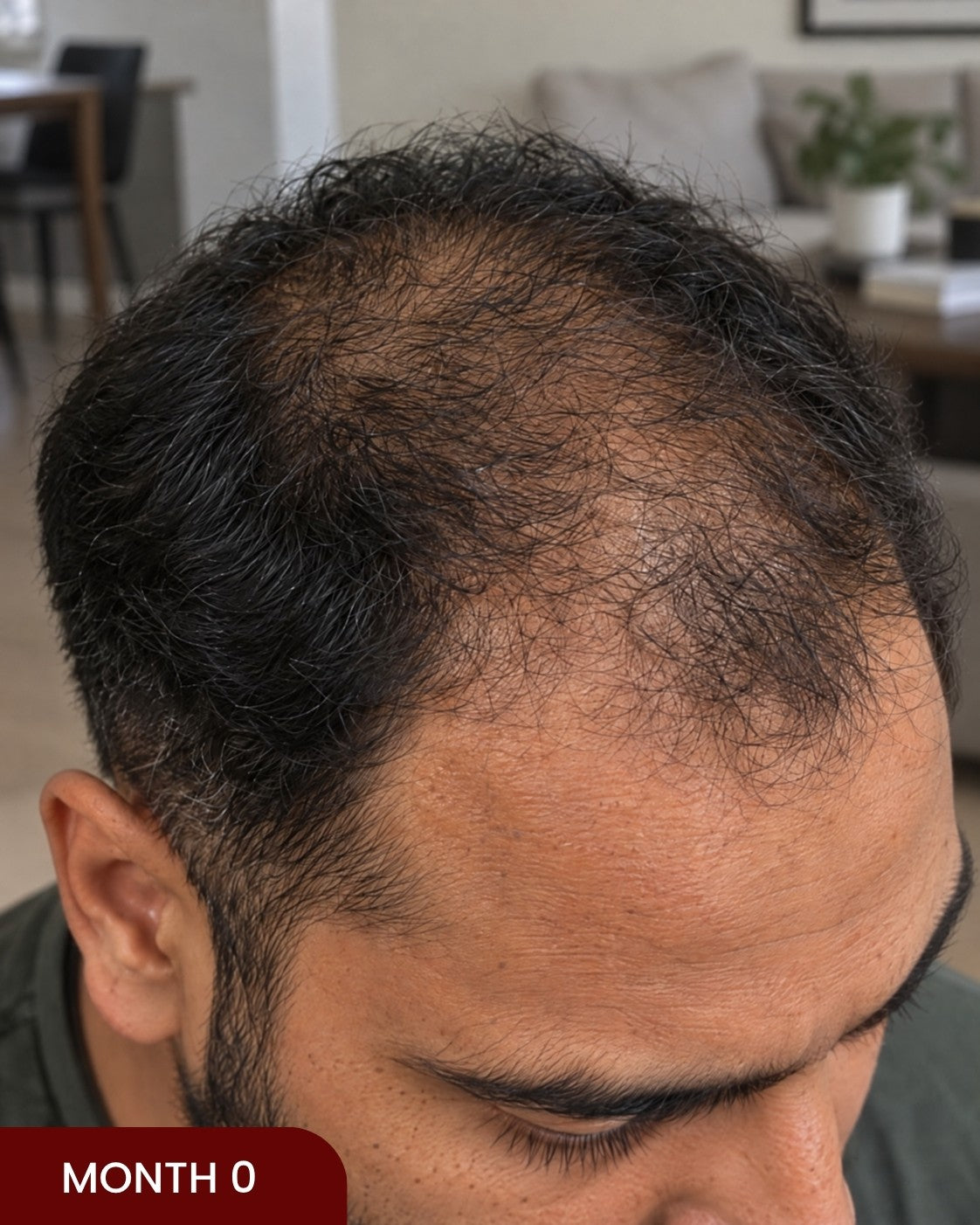 Before hair progress photo