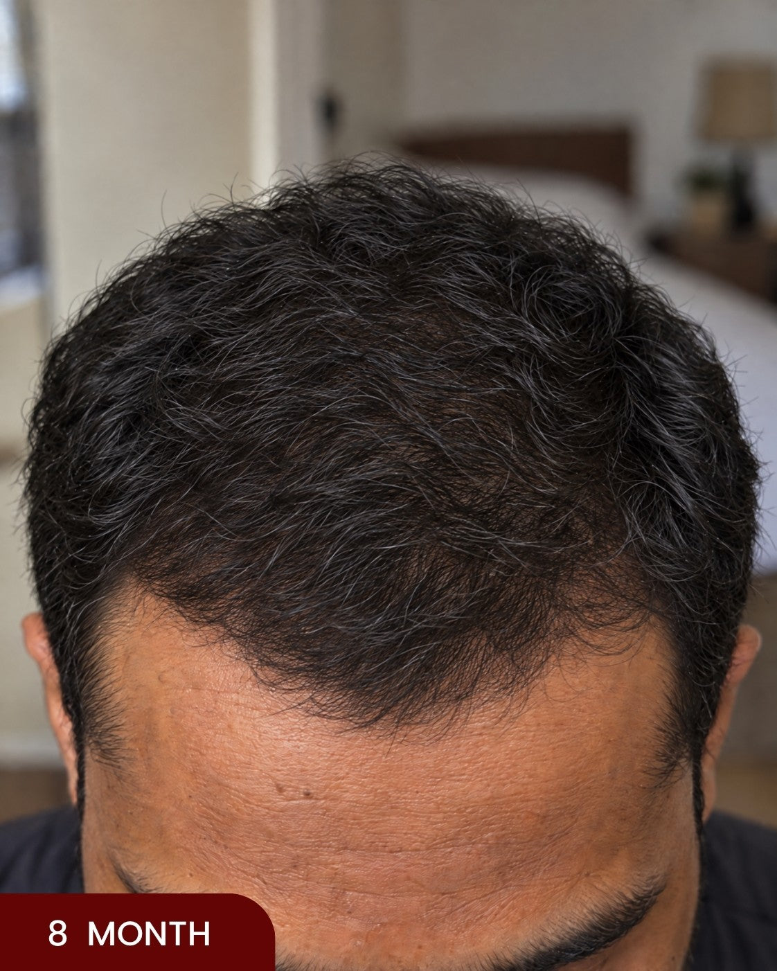 After hair progress photo