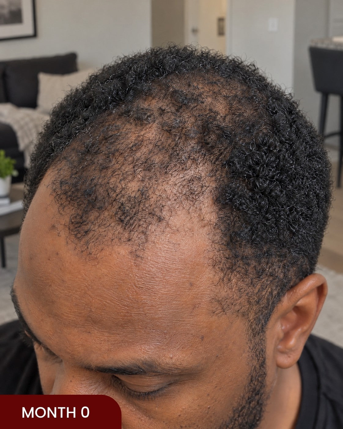 Before hair progress photo