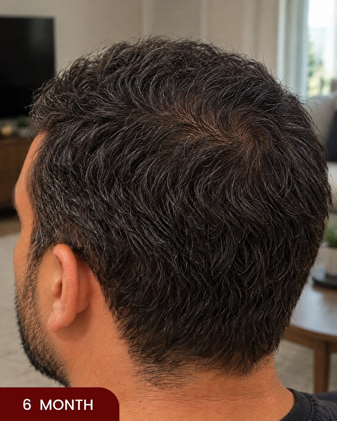 After hair progress photo