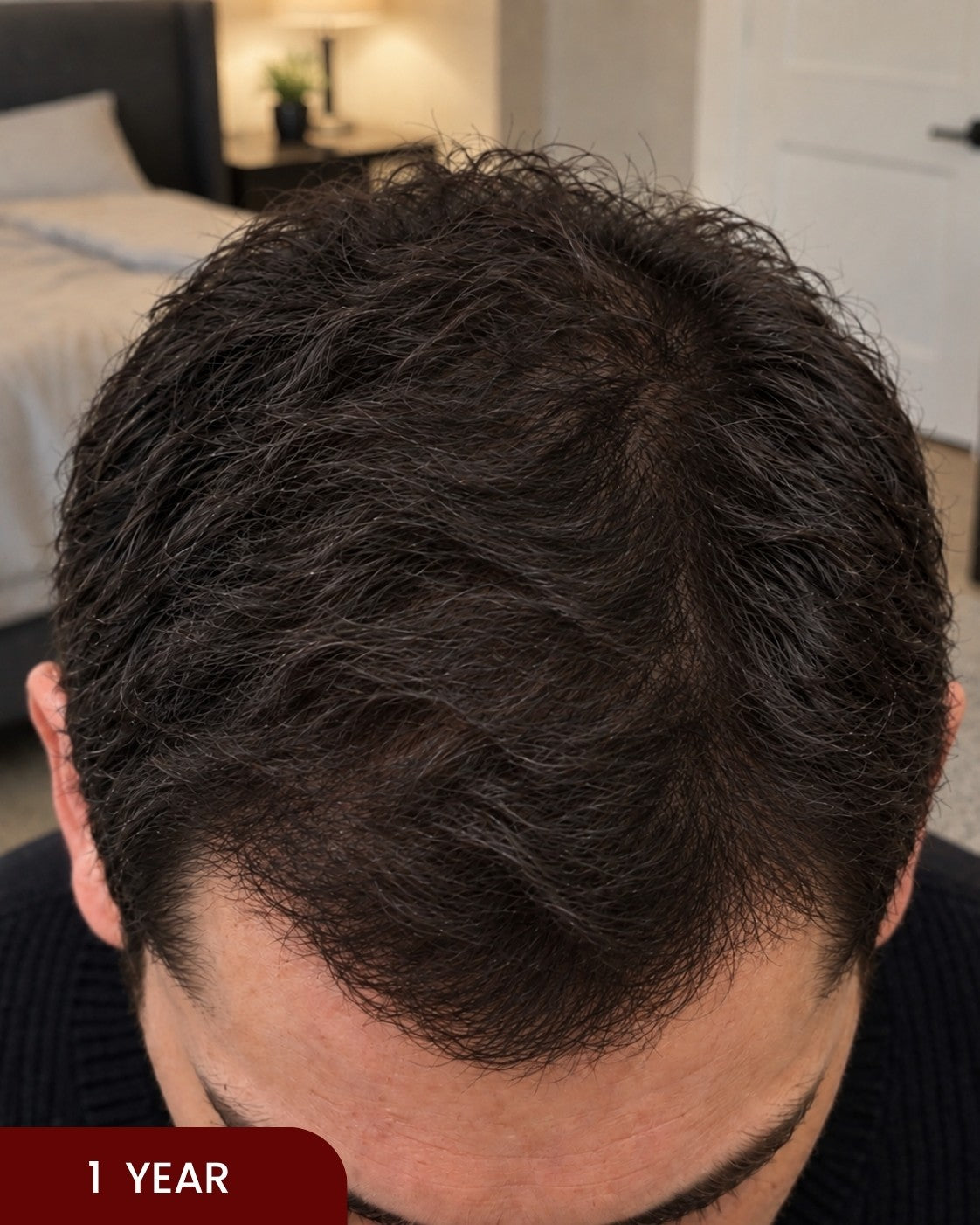 After hair progress photo