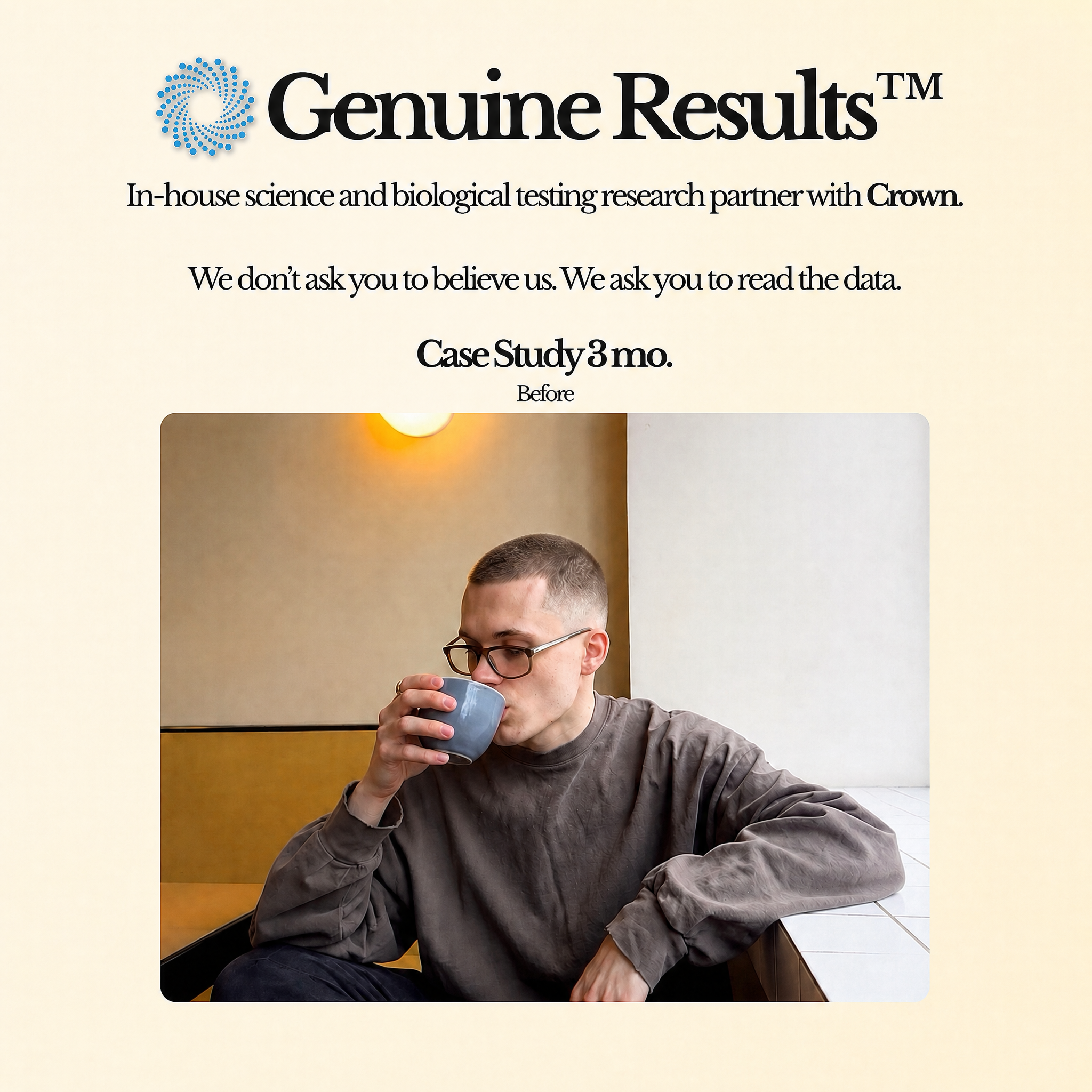 CROWNS Genuine Results Before