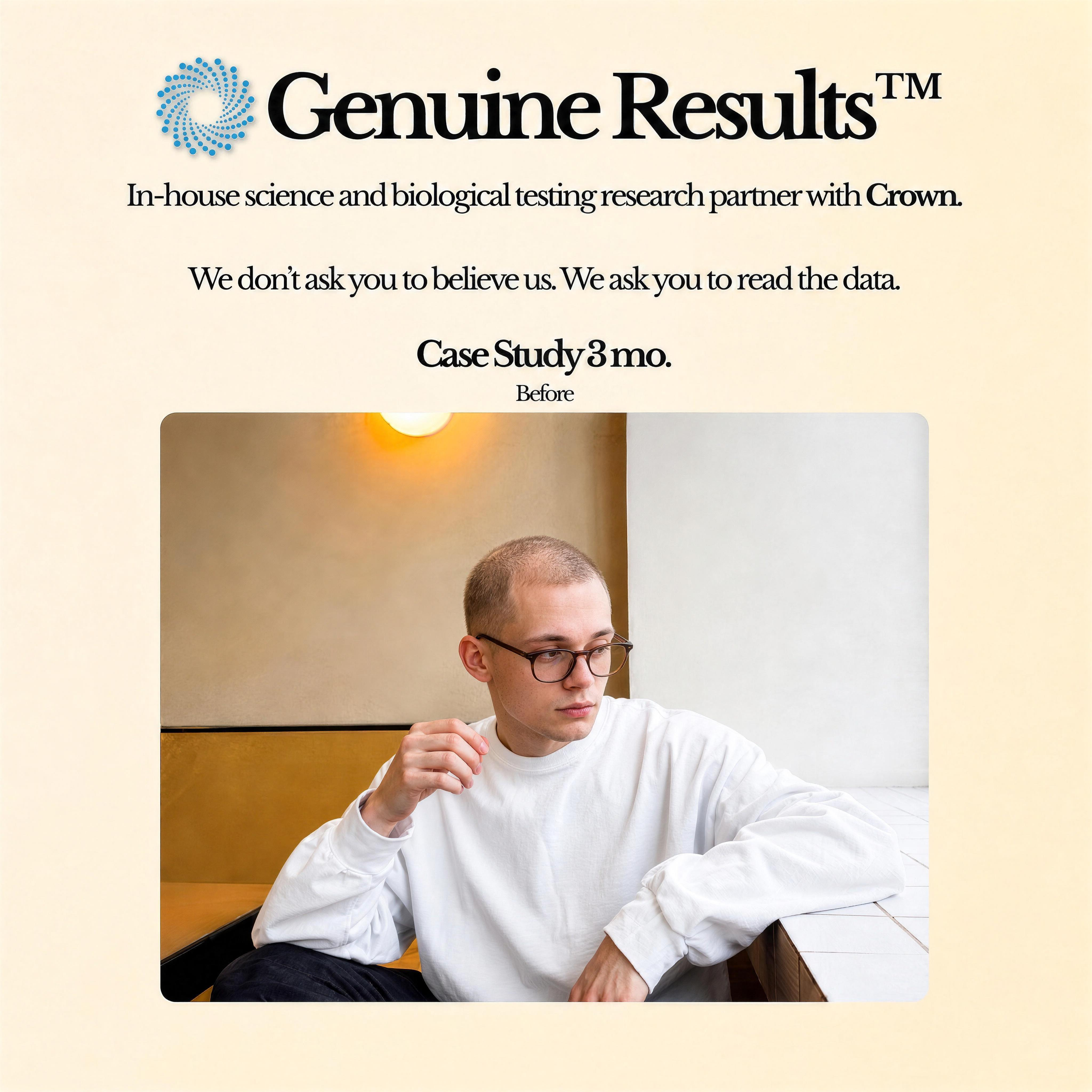 CROWNS Genuine Results Before