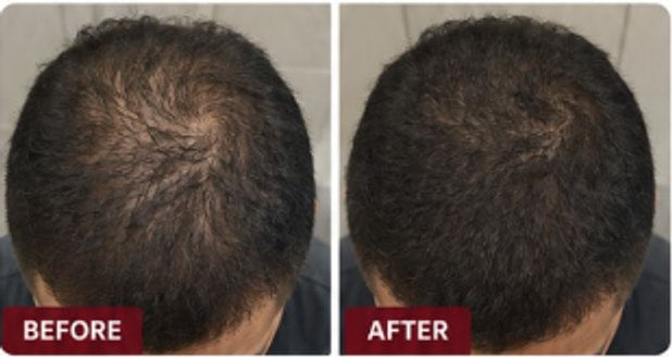 Hair comparison before the routine and after consistent use