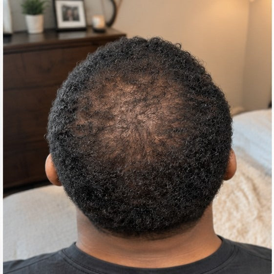 Diego at-home hair progress, month 3