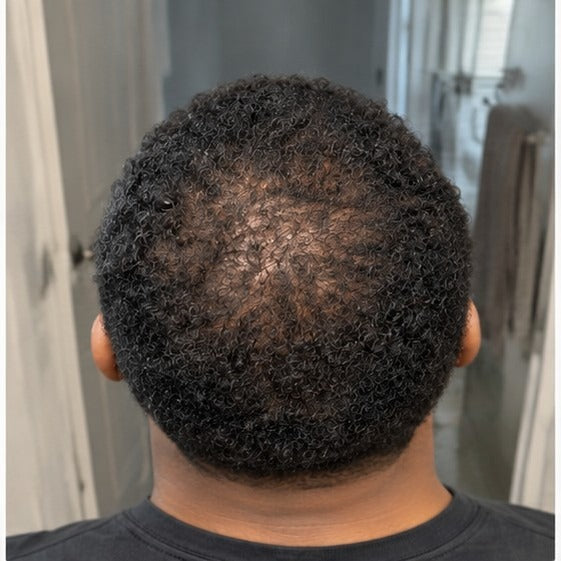 Diego at-home hair progress, month 5