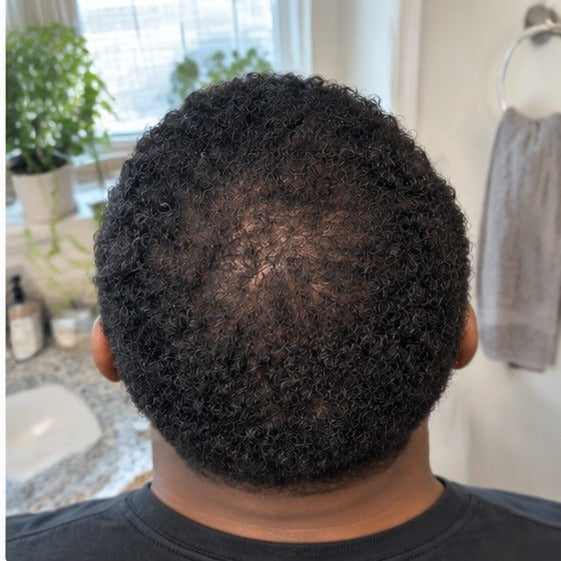 Diego at-home hair progress, month 12