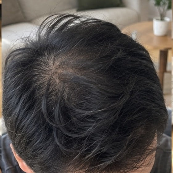 Kenji hair progress, month 4
