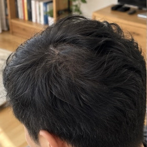 Kenji hair progress, month 6