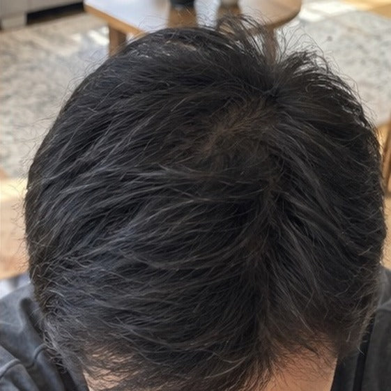 Kenji hair progress, month 9