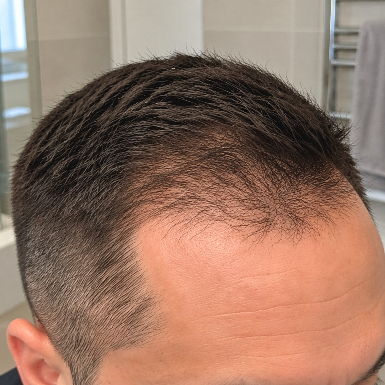 Miguel at-home hair progress, month 0