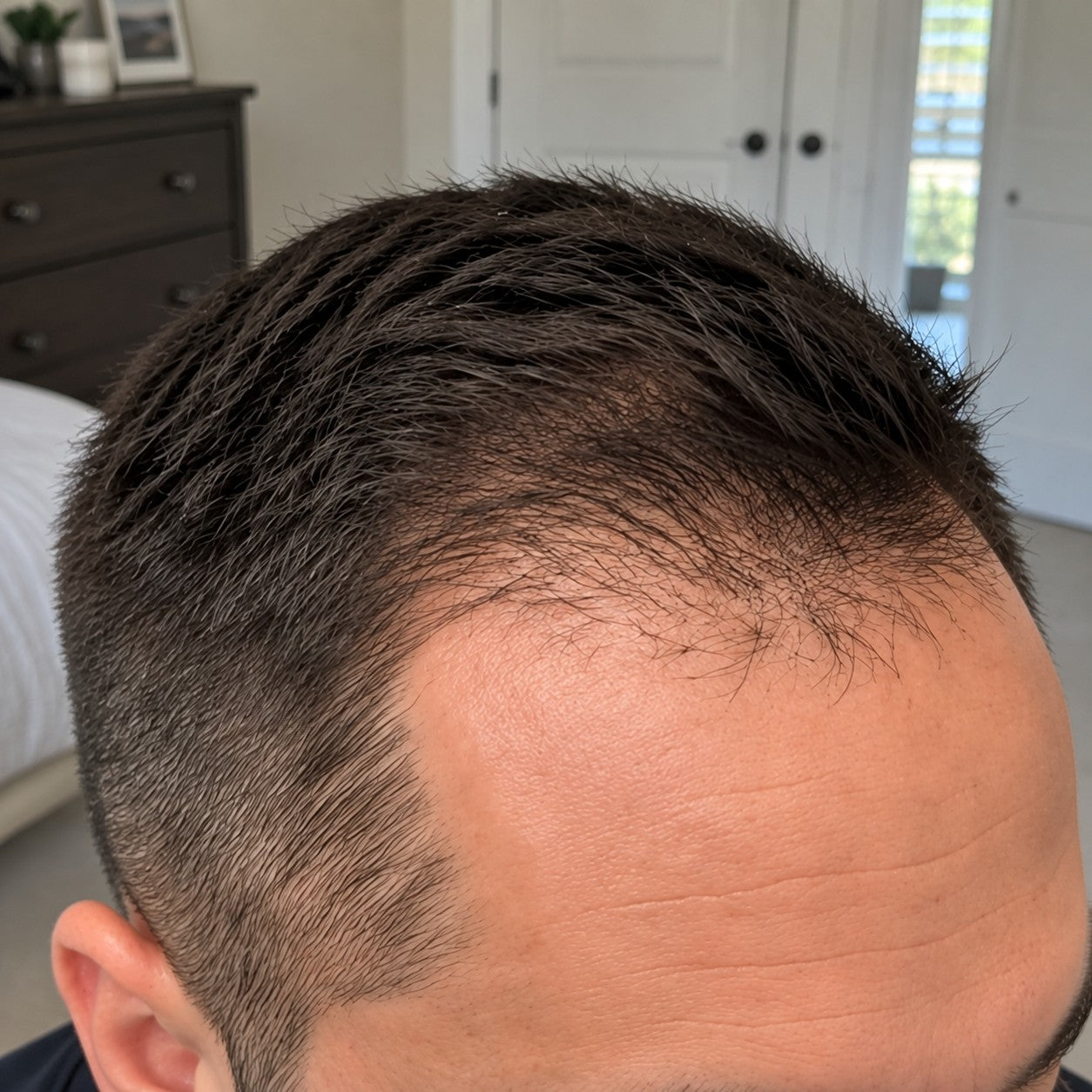 Miguel at-home hair progress, month 2