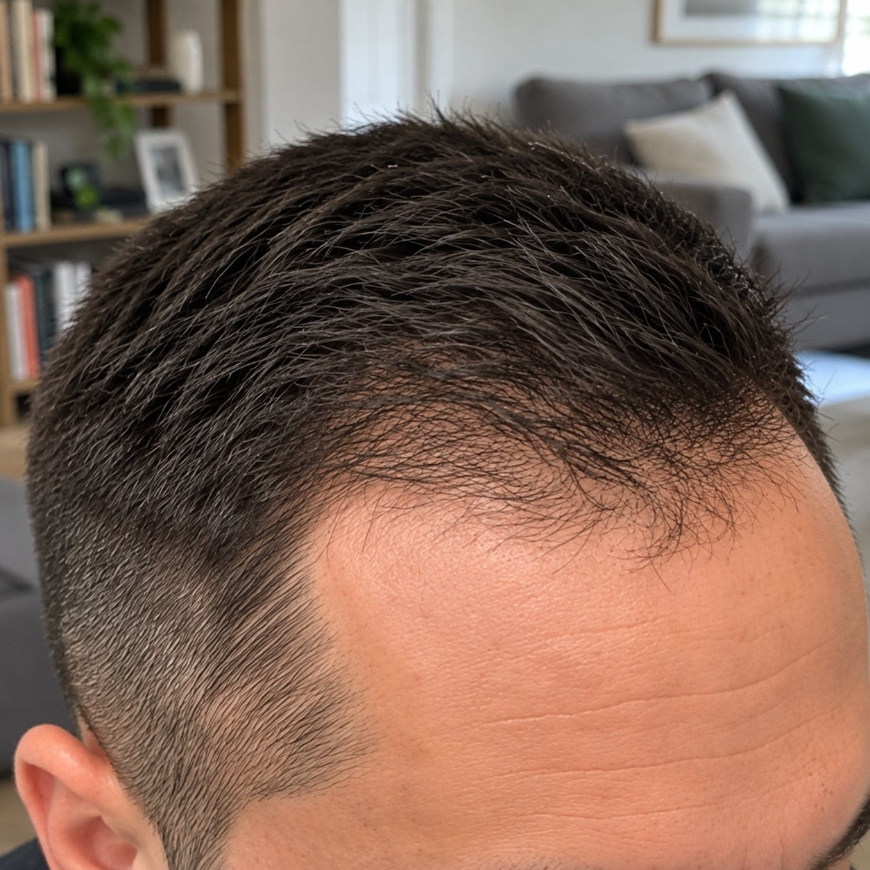 Miguel at-home hair progress, month 4