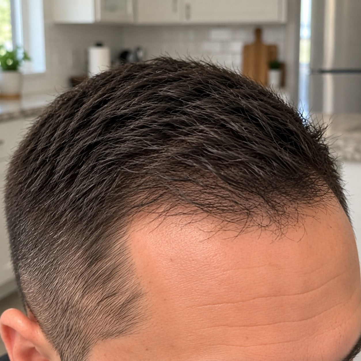 Miguel at-home hair progress, month 6