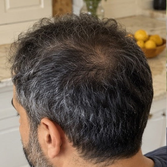 Samir hair progress, month 9