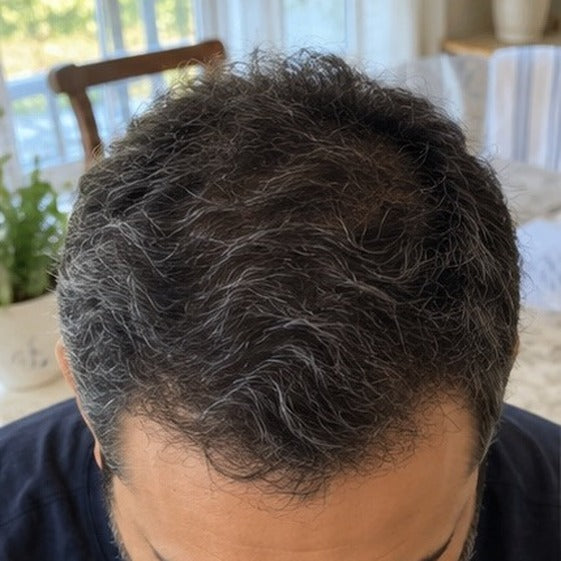 Samir hair progress, month 12