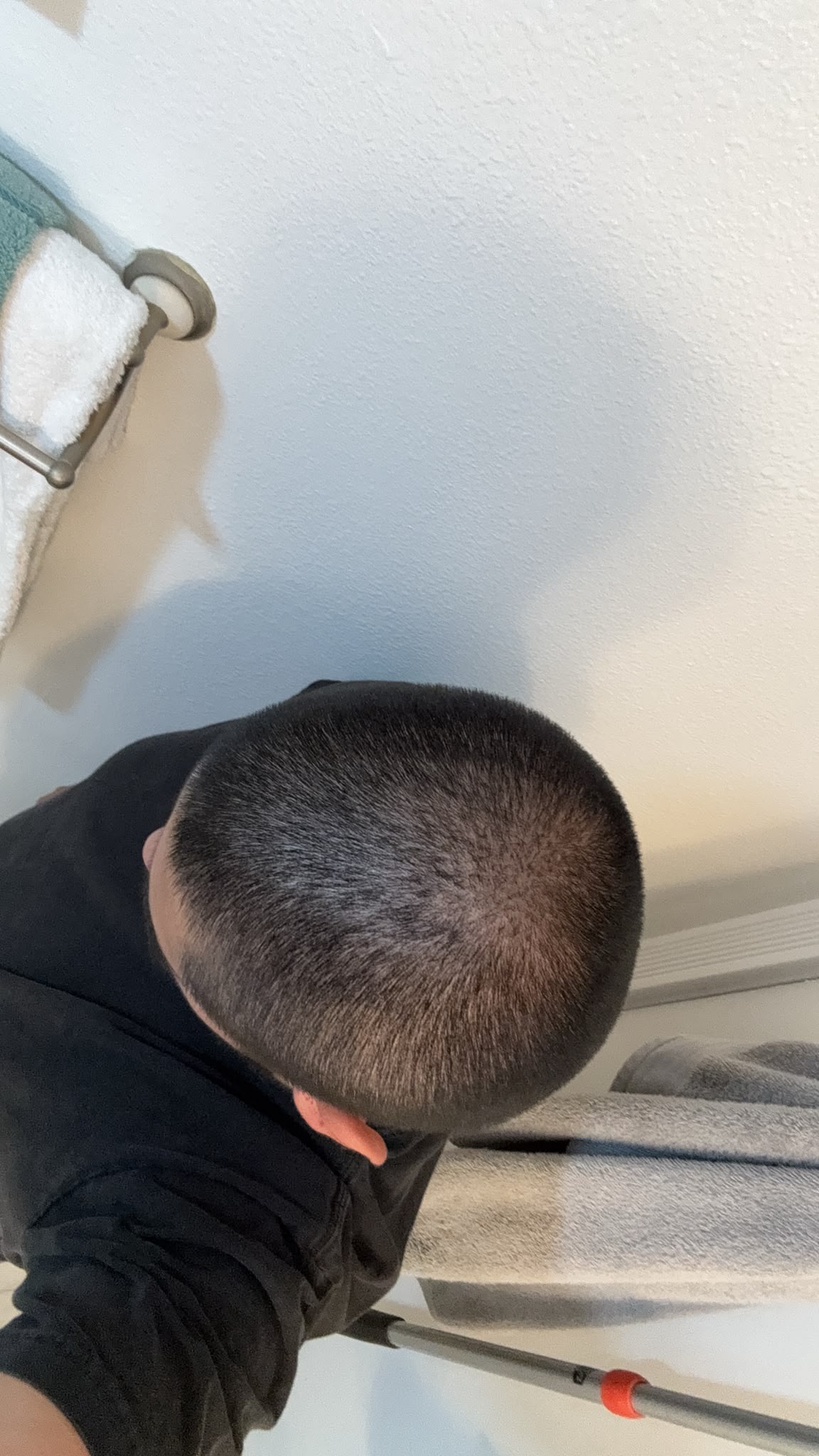 Crowns case study at month thirteen