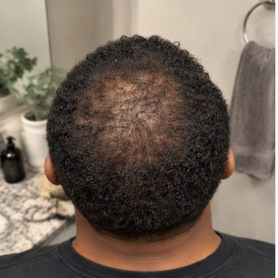 Diego at-home hair progress, month 0