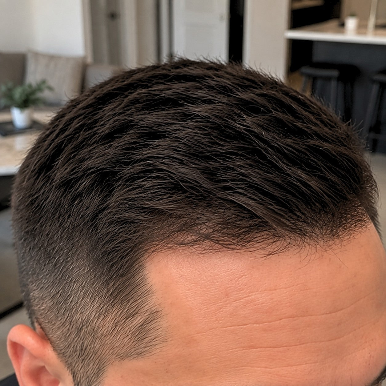 Miguel at-home hair progress, month 8
