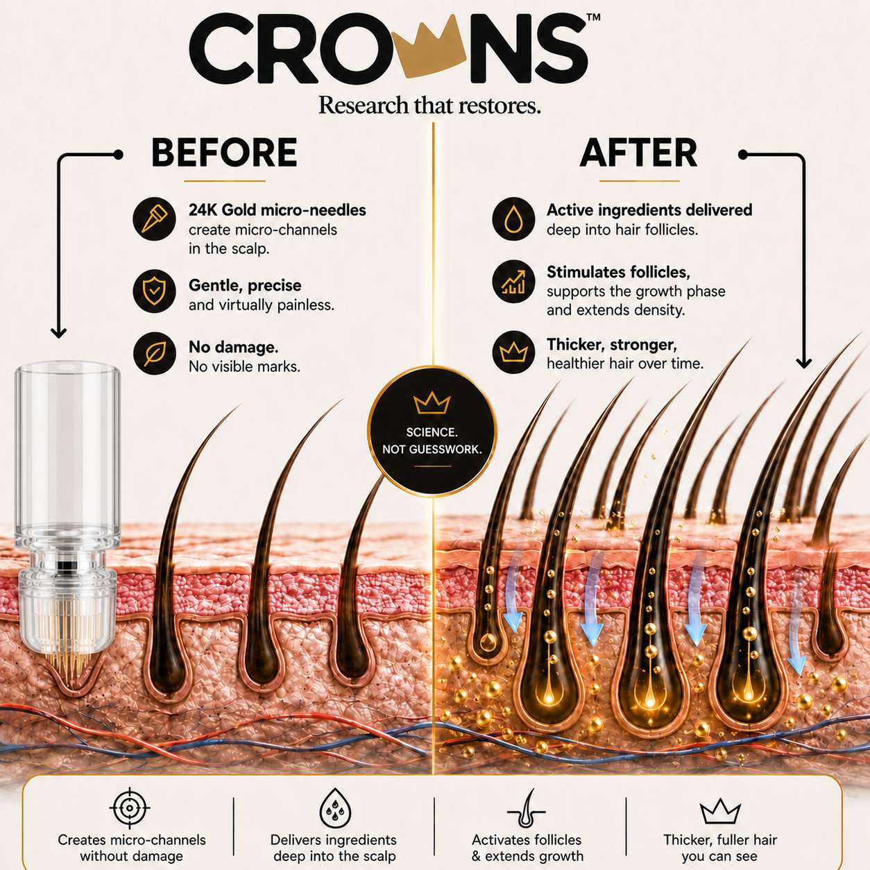 CROWNS micro-infusion research diagram