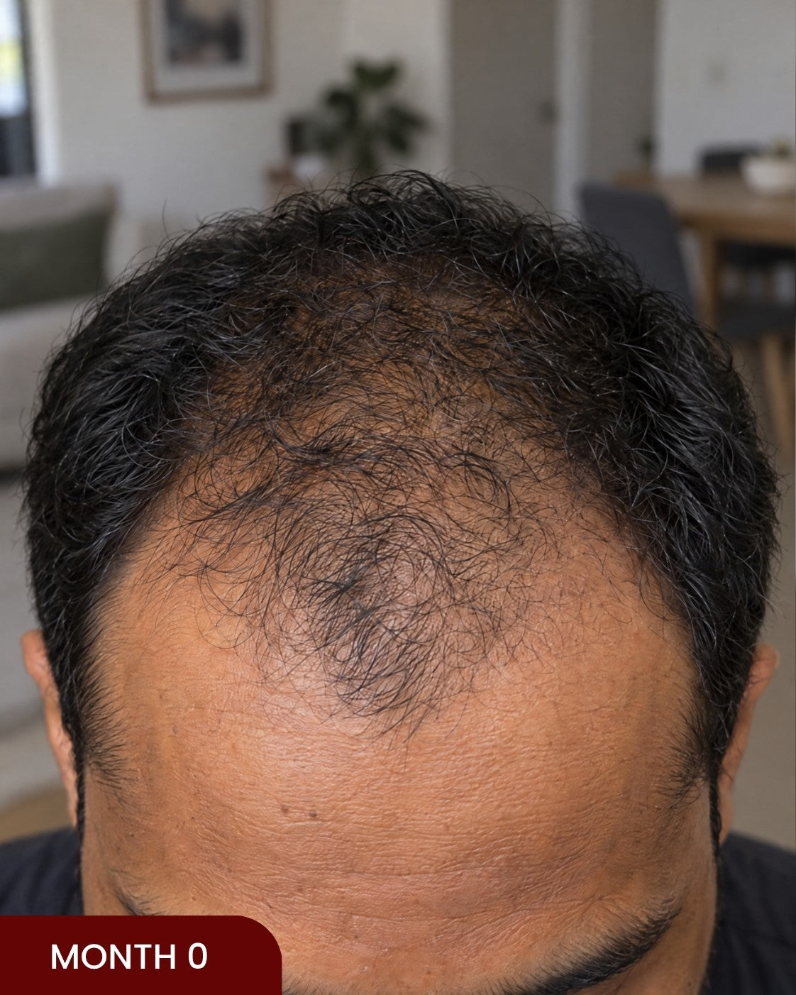 Before hair progress photo