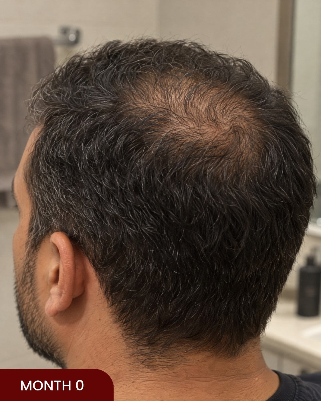 Before hair progress photo